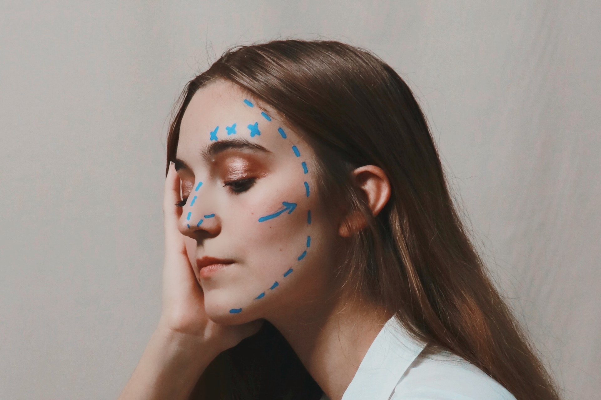 Woman with blue facelift marks on her face