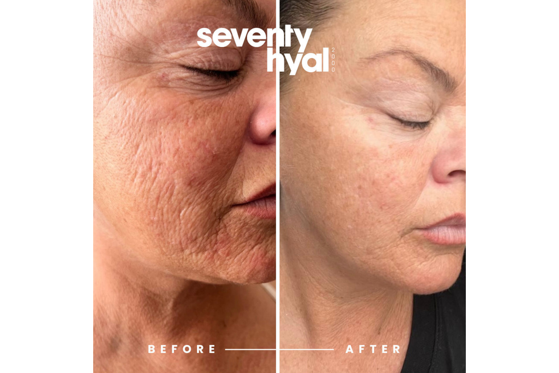 Before and after skin