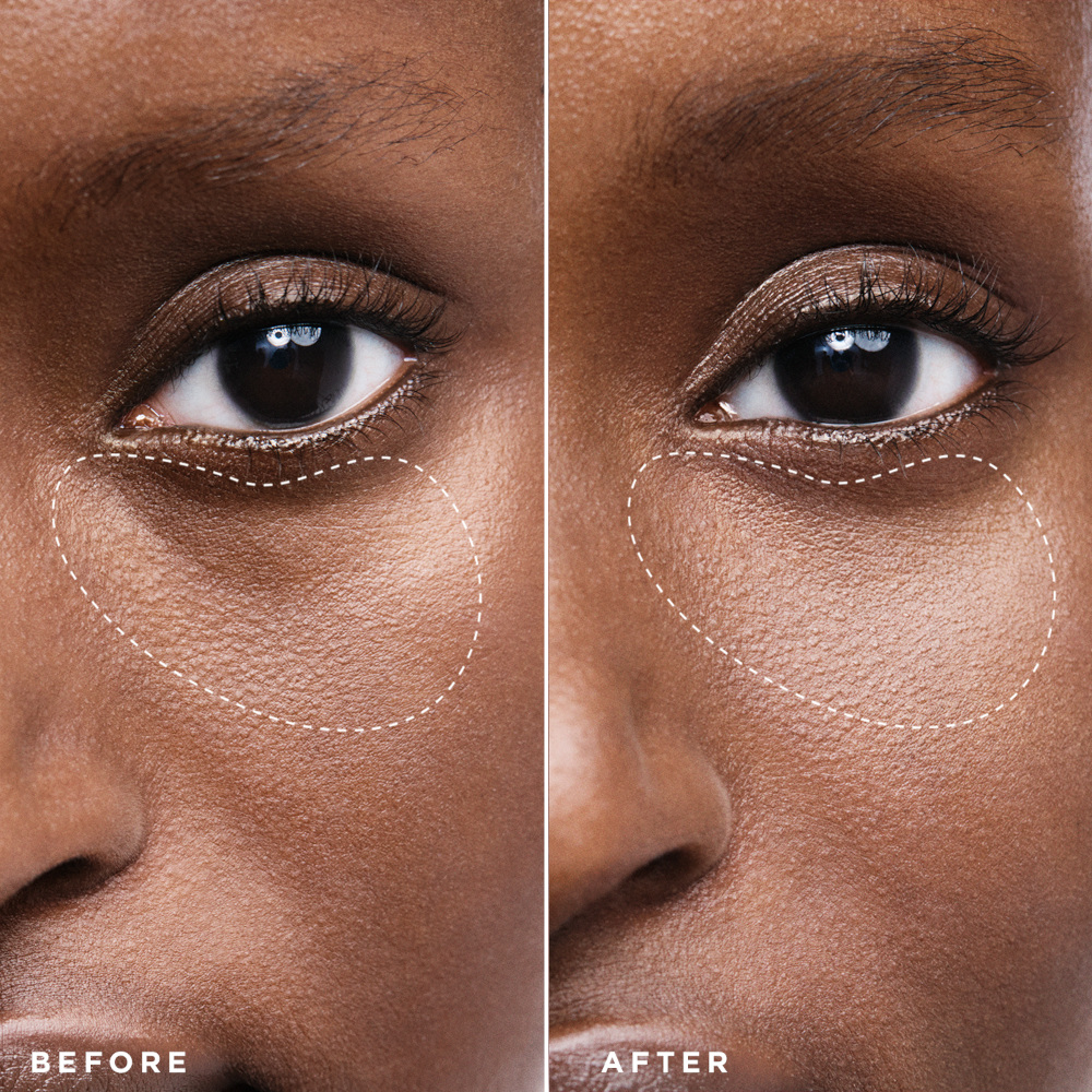 Before and after