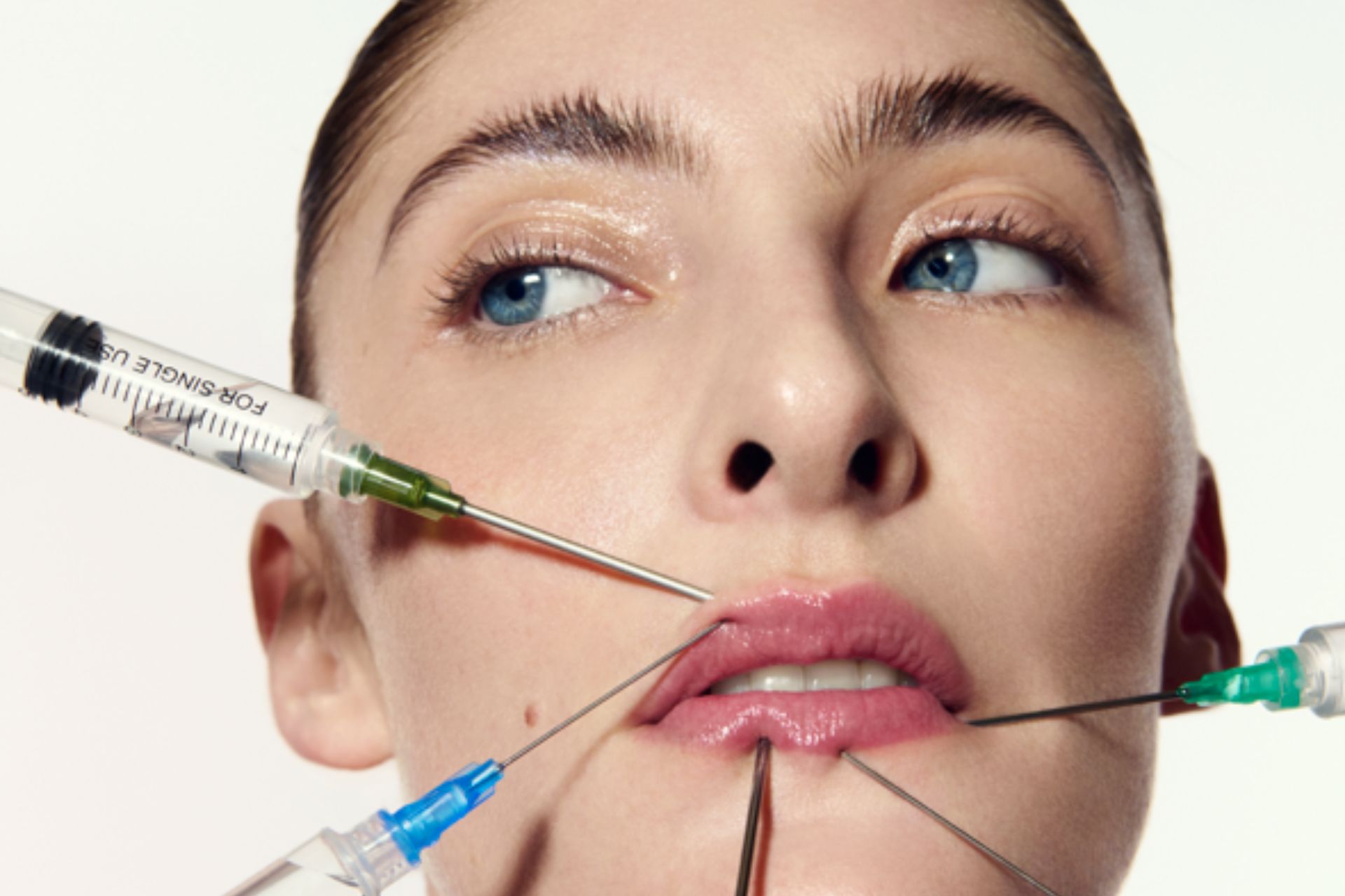 Model with five filler needles surrounding her