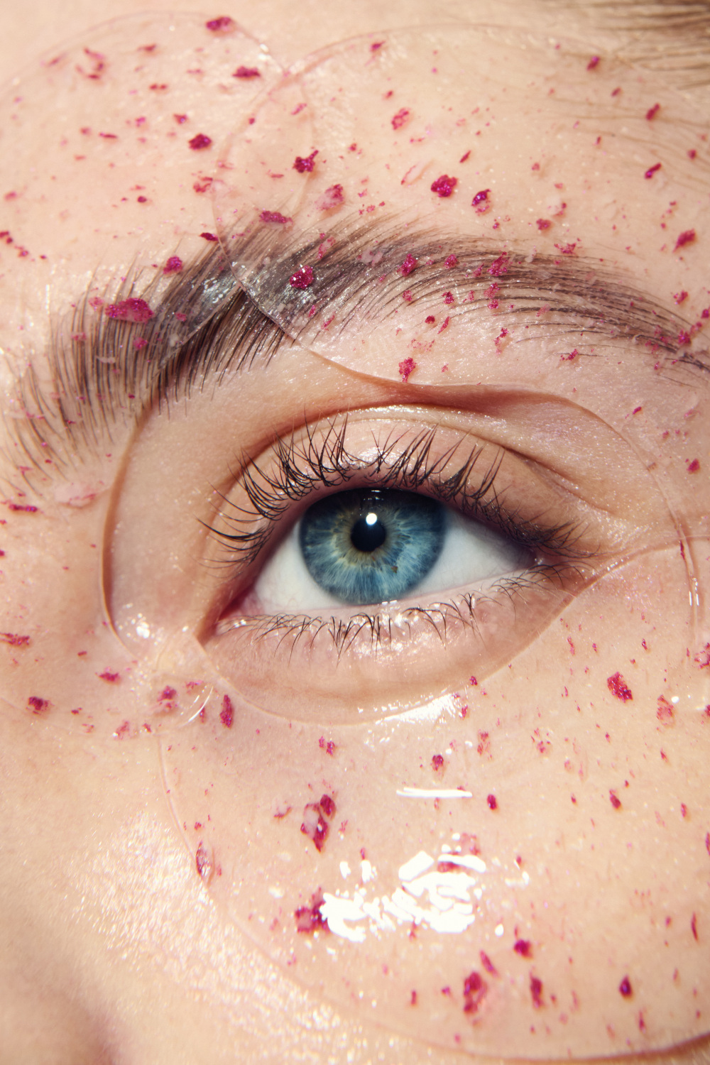 Seeing Is Believing: Inside The Eye Surgery Boom