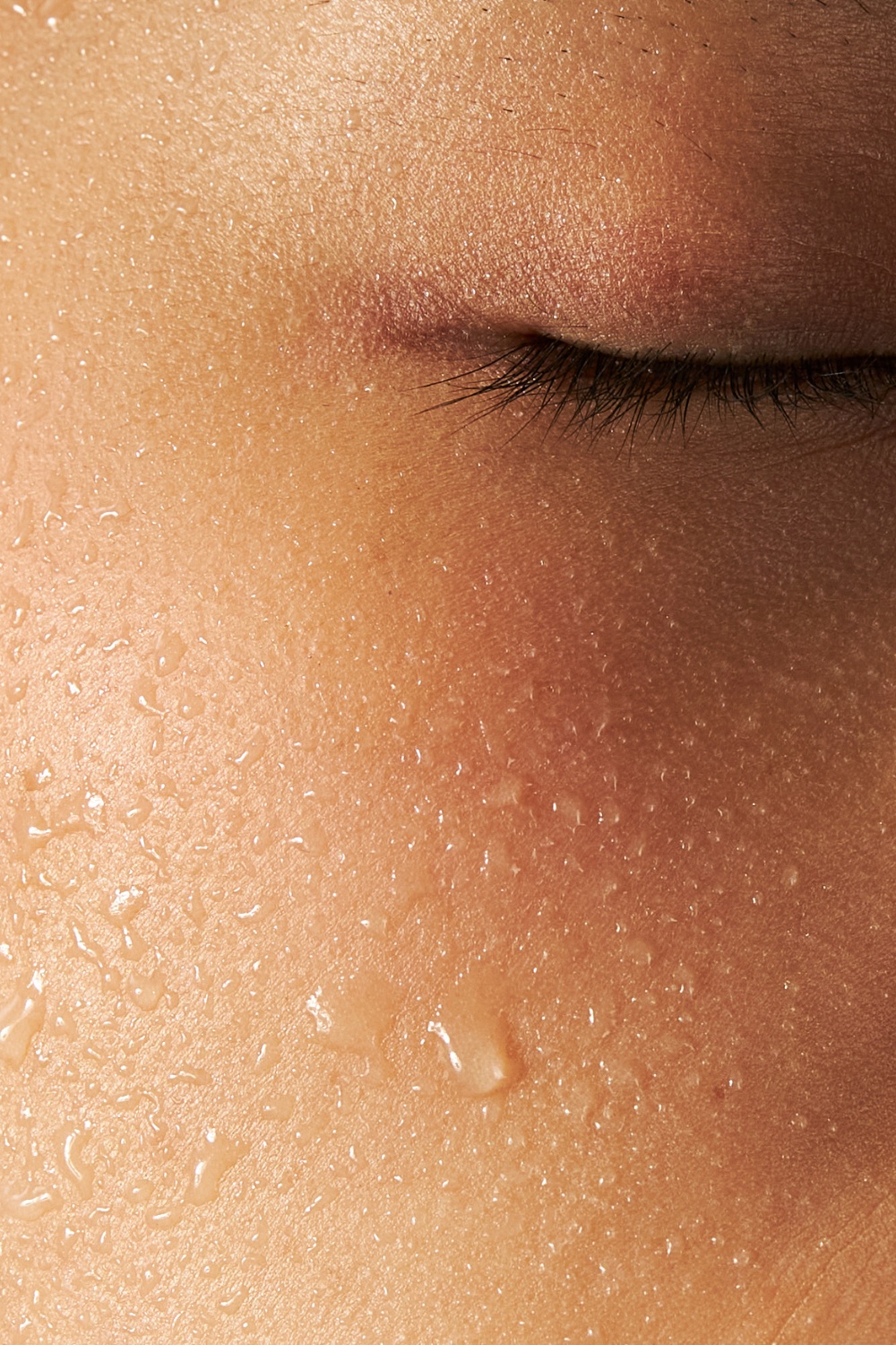 Skin sweating in a heatwave