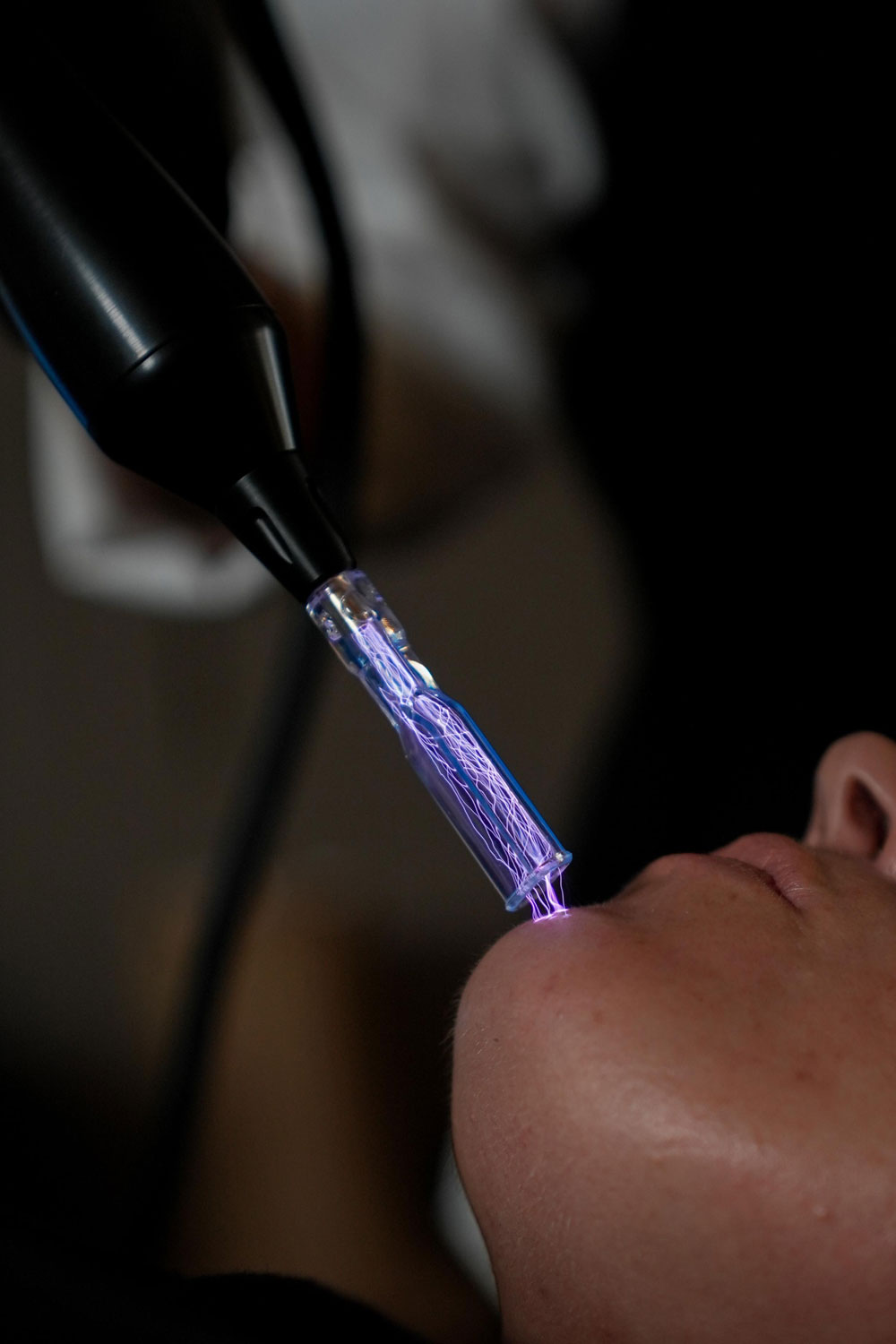 Hyper Plasma Fusion Go by Plasma pen