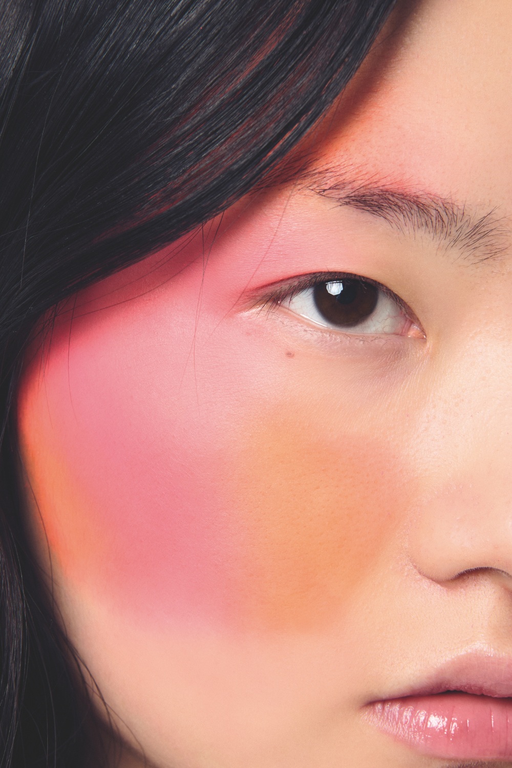Woman with pigmentation